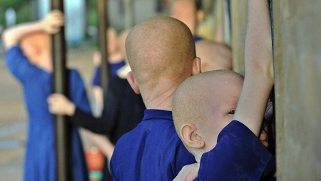 Les enfants albinos sont en danger dans beaucoup de pays d'Afrique. © TONY KARUMBA / AFP